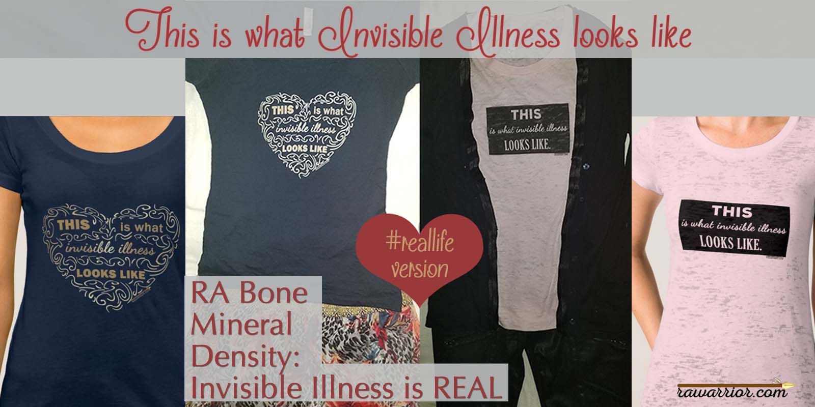 RA Bone Mineral Density is another indicator of invisible illness in RA / RD