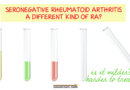 Seronegative Rheumatoid Arthritis Is Hazy