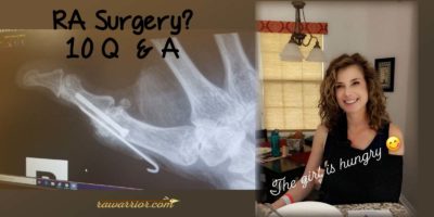 RA surgery 10 questions