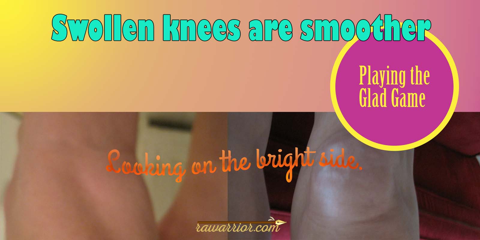 swollen knees are smoother
