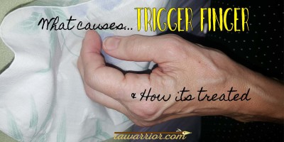 Trigger Finger in Rheumatoid Arthritis