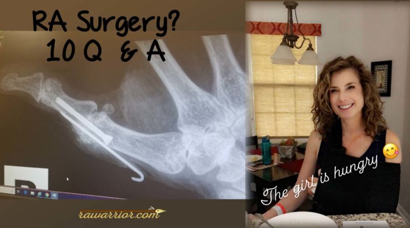 RA surgery 10 questions